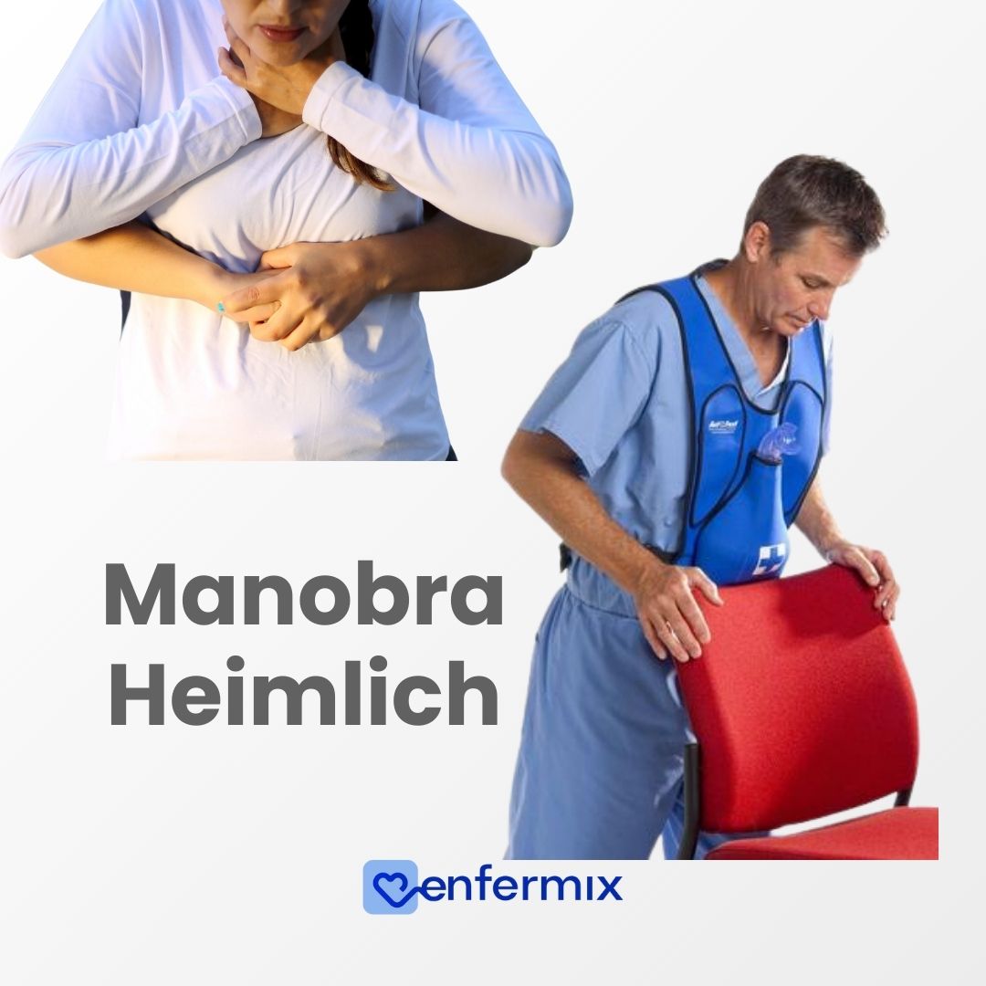 Manobra de Heimlich: Como Agir em Casos de Engasgo e Salvar Vidas