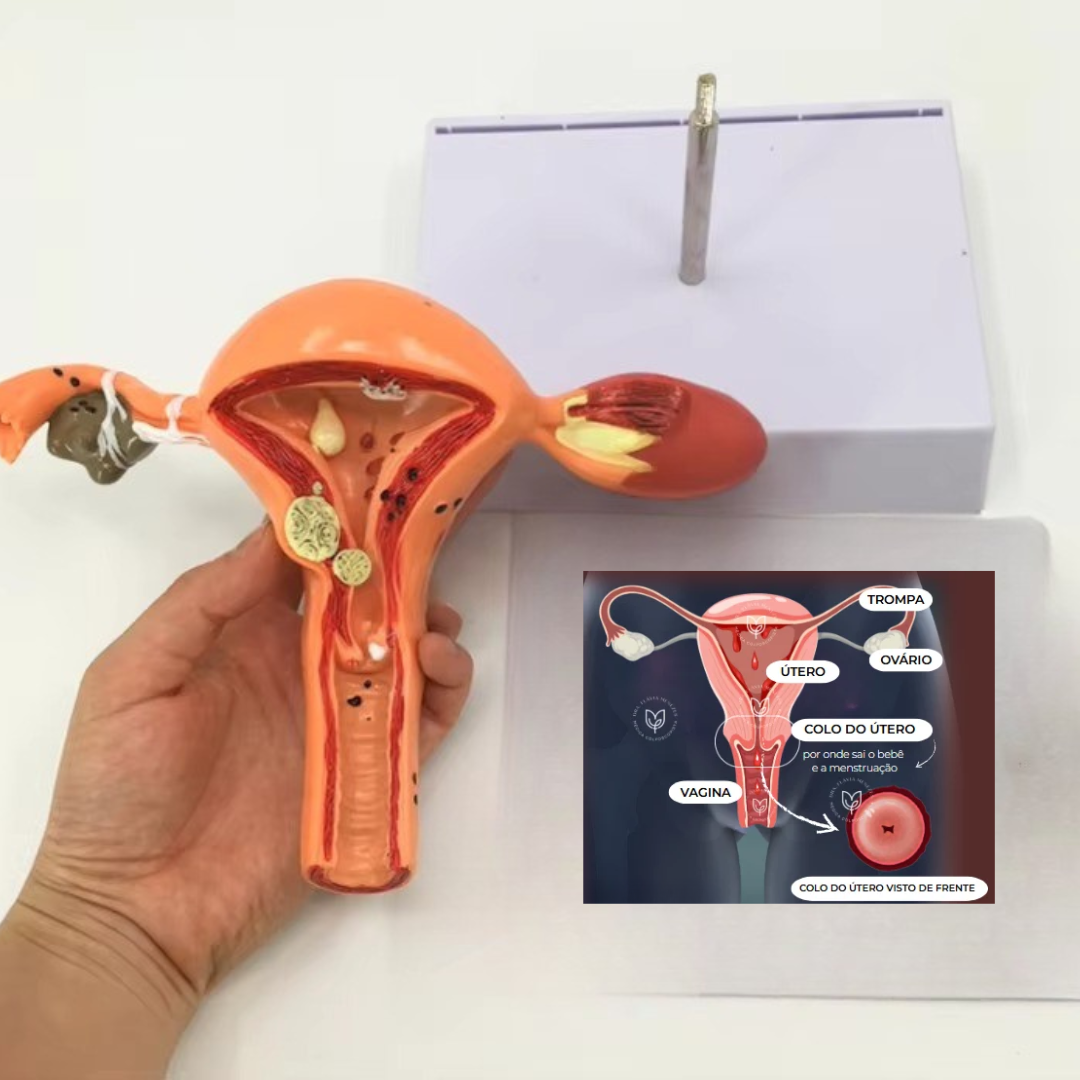 Útero Anatomia e Colo do Útero – Modelo Anatômico com Ovário para Estudo e Ensino